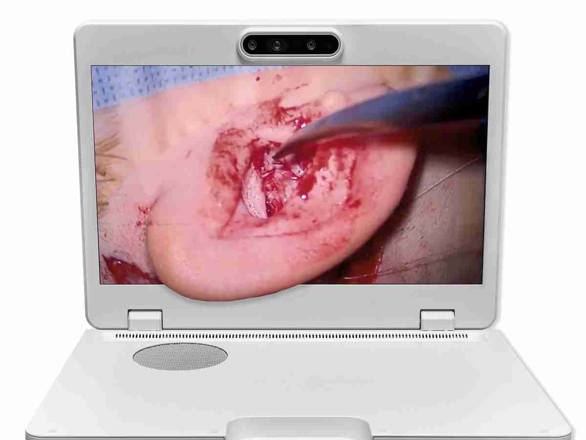 达擎之＂Heads-up 3D显微手术显示系统＂，，，，整合4K裸眼3D显示及眼球追踪系统，，，，具备快速追踪人眼移动位置功能，，，减轻医师长时间维持固定姿势的负担，，让医师能有更宽广清晰的3D立体视野及更舒适的姿势来执行手术。。。